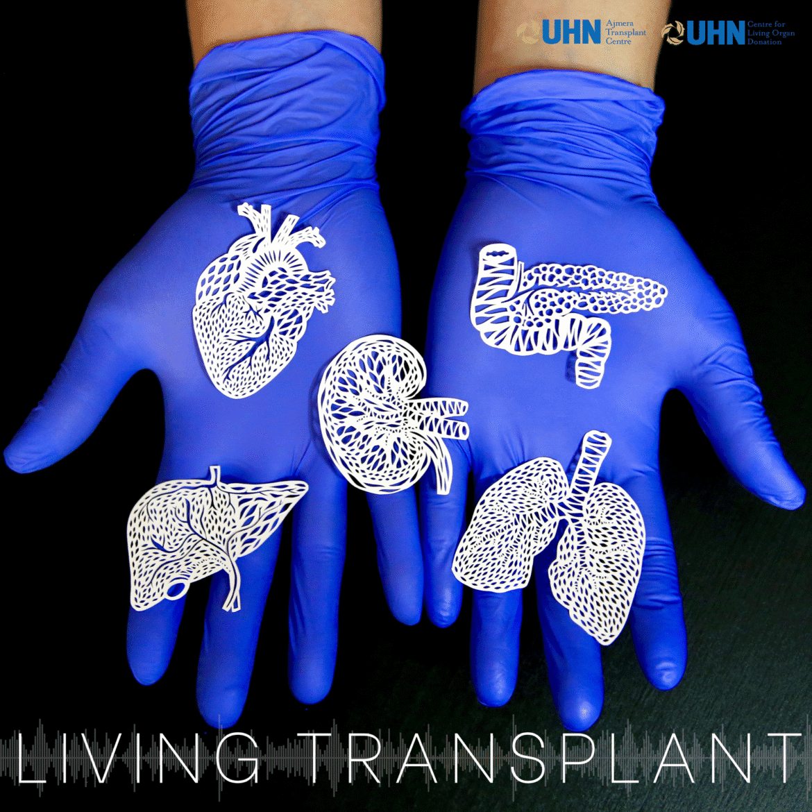 Indigenous ways of knowing: kidney transplant