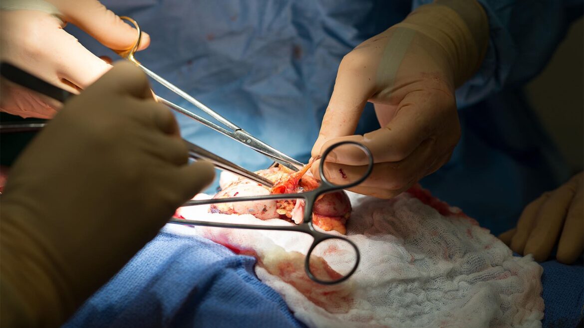 Does An Organ Transplant Cause Personality Changes?