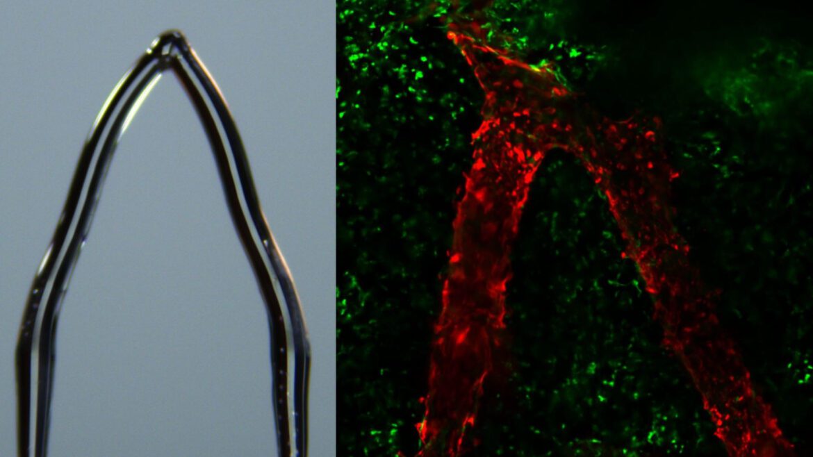 Interesting Engineering Ice 3d Printing Eliminates Queues For Organ Transplants