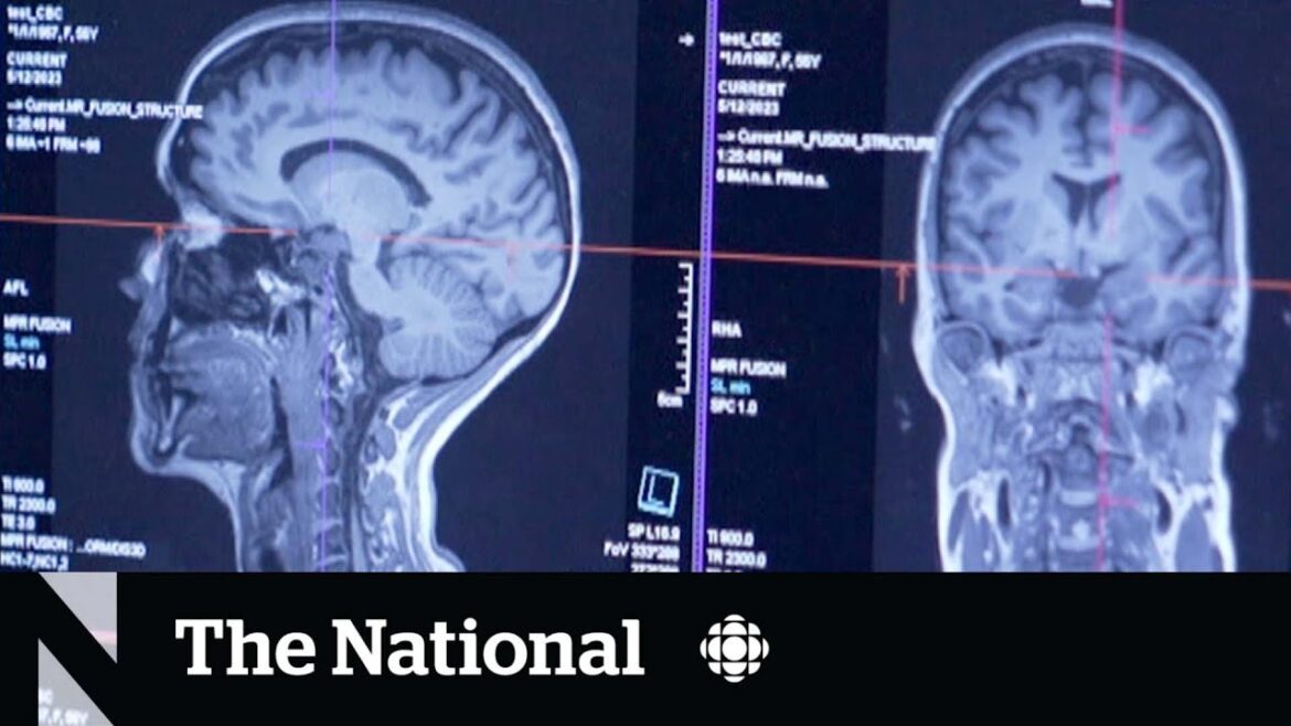 What Motivates An Organ Donor? The Secret Could Be In