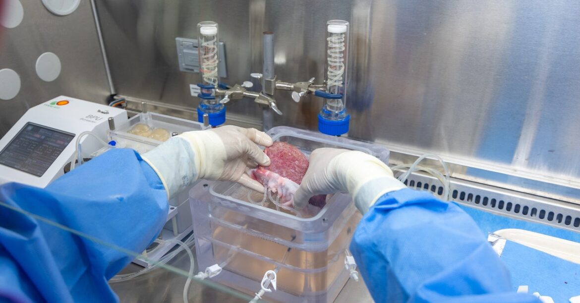 The Next Frontier For Mrna Could Be Healing Damaged Organs