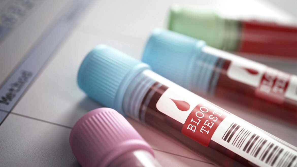 Cms Withdraws Controversial Proposal For Post Transplant Blood Testing