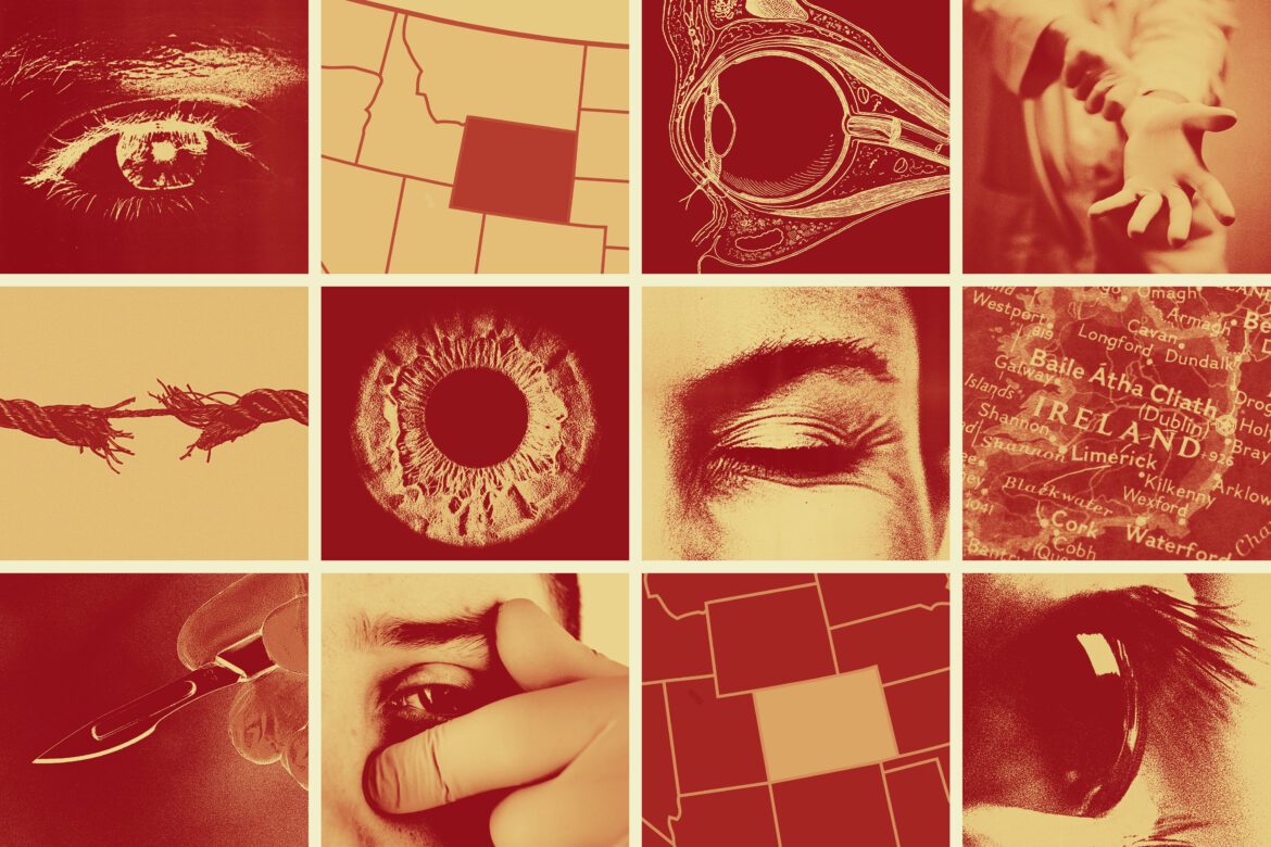 Ex Eye Bank Workers Say Pressure, Lax Oversight Led To Errors