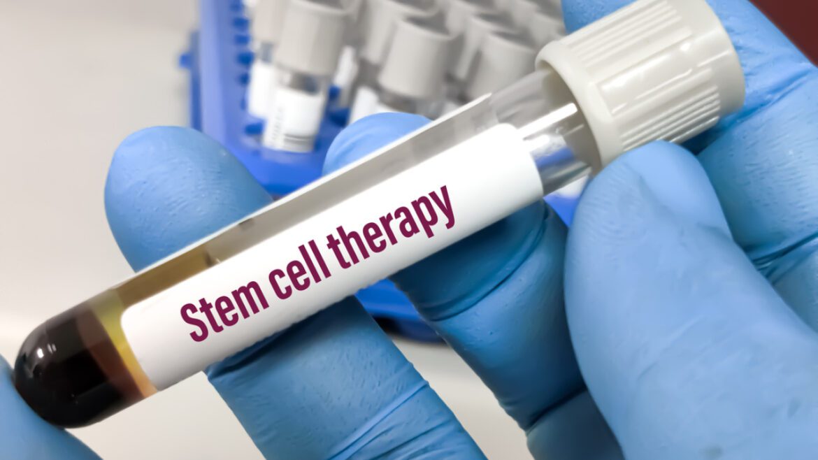Stem cell