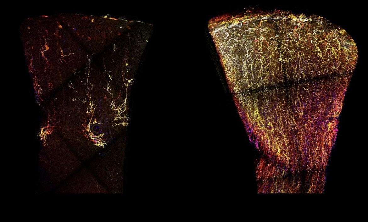 Kidney lymphatics dj