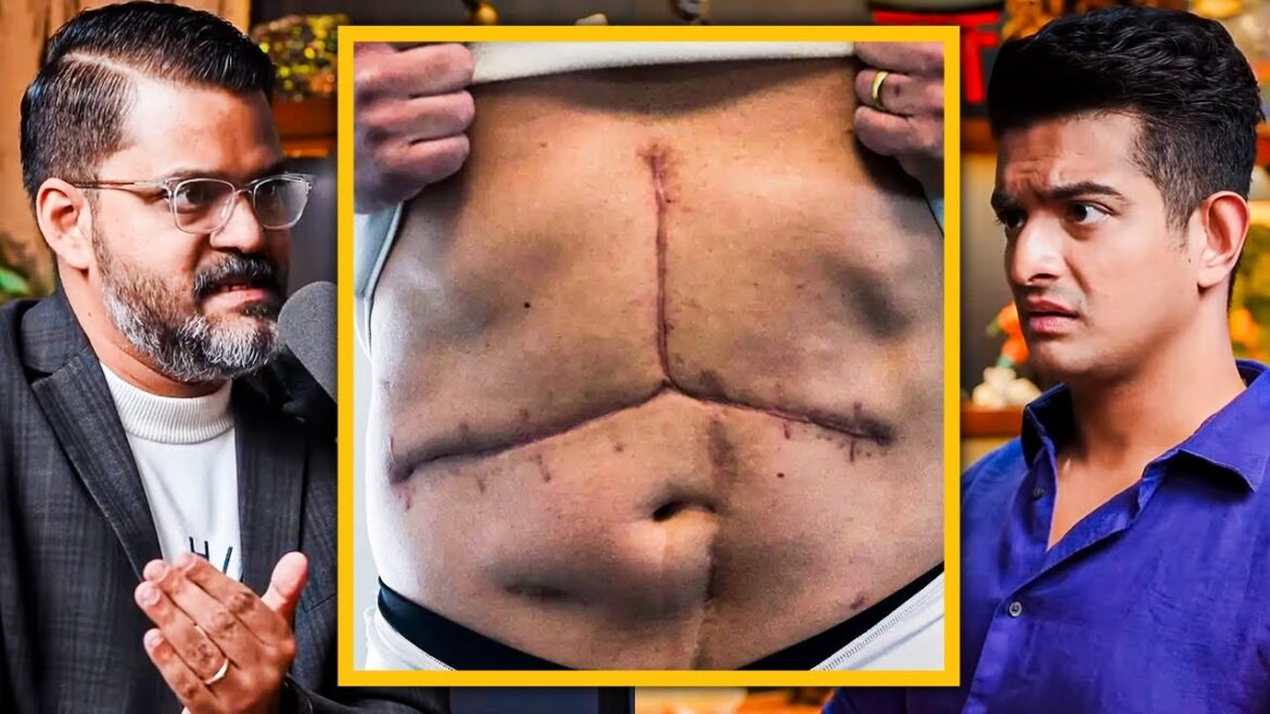 Dark side of organ transplant industry in india liverdoc