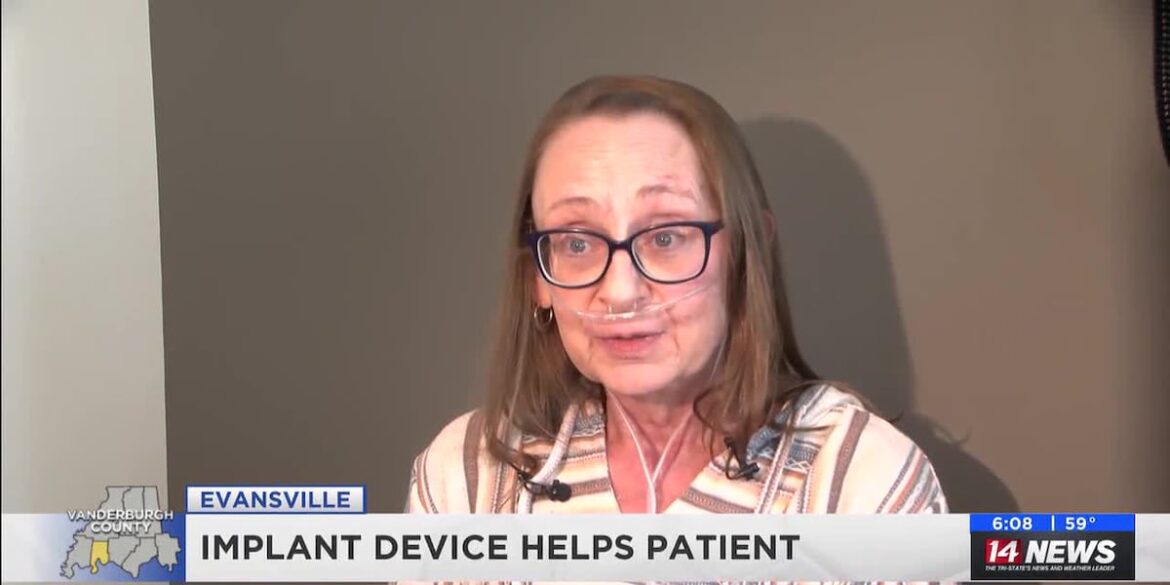 U42fkvu7tvc3fbgmkxpge4j5hm