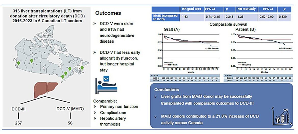 Liver transplantation