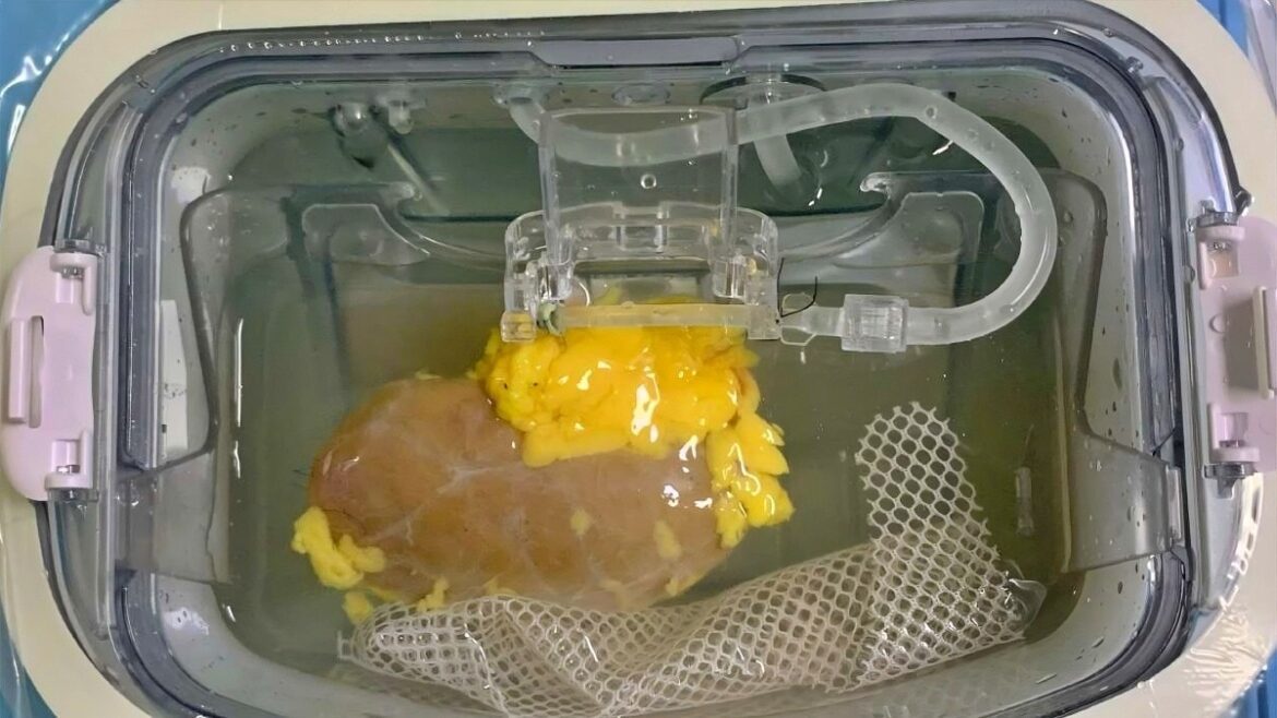 Universal kidney 212119982 16x9 0