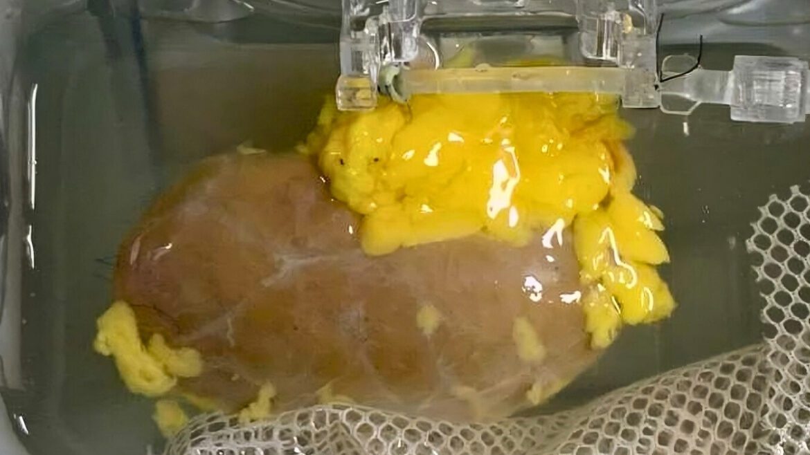 Universal kidney
