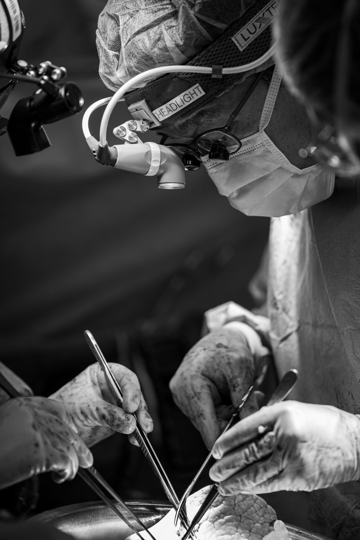 Lung transplant lung 2