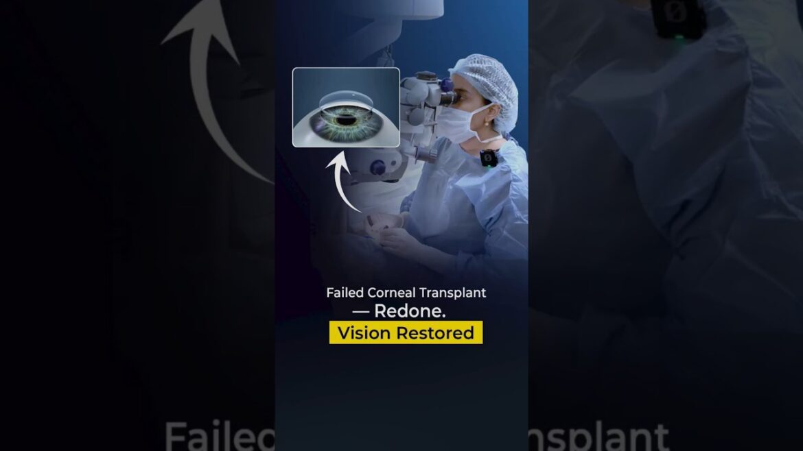 Failed corneal transplant redone | vision restored